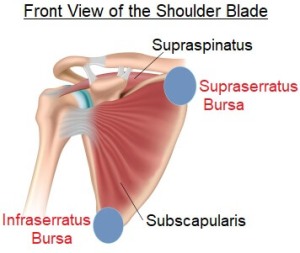 scapulothoracic-bursitis-shoulder